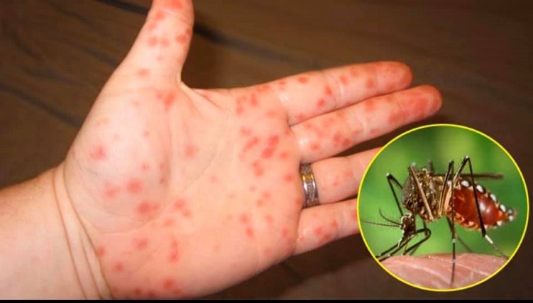 Cách phòng chống bệnh sốt xuất huyết tại nhà-2